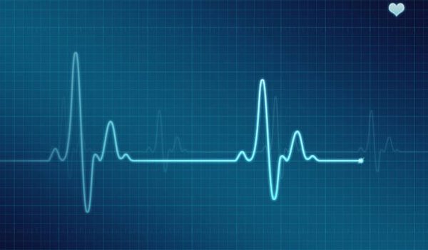 Heart rate graph